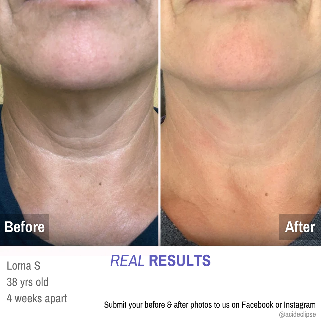 Pure™ Tighten & Lift Neck Cream